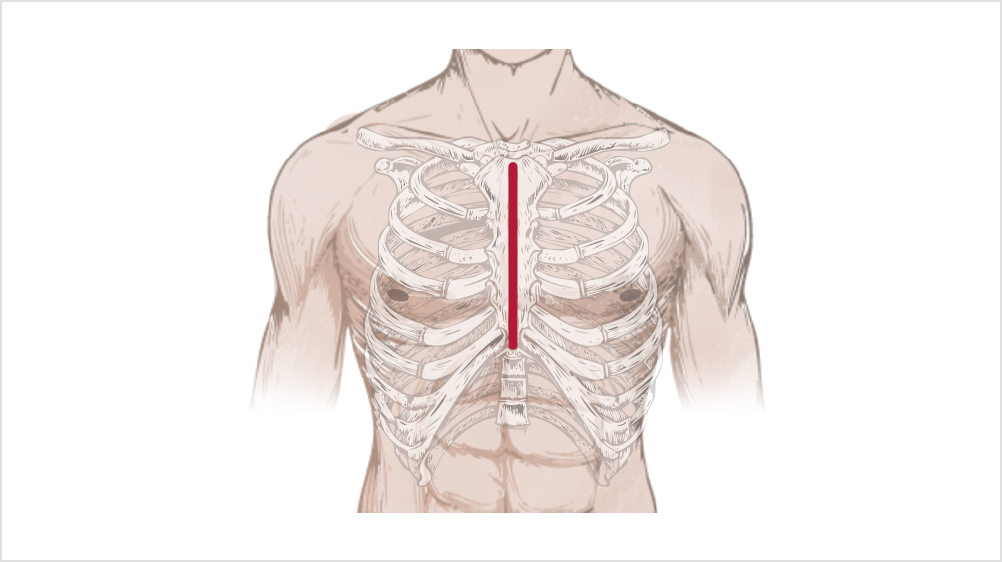 胸骨正中切開