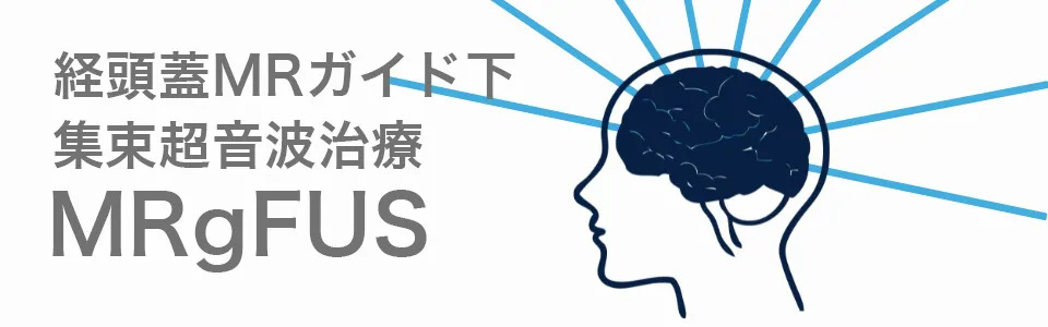 経頭蓋MRガイド下集束超音波治療(MRgFUS)